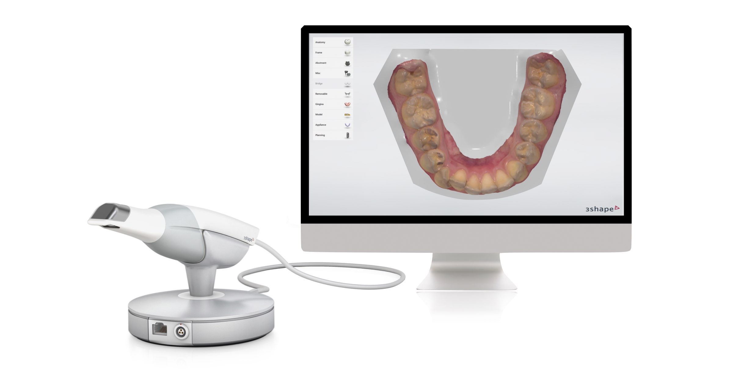 Ortodonzia digitale: che cos’è e i suoi vantaggi