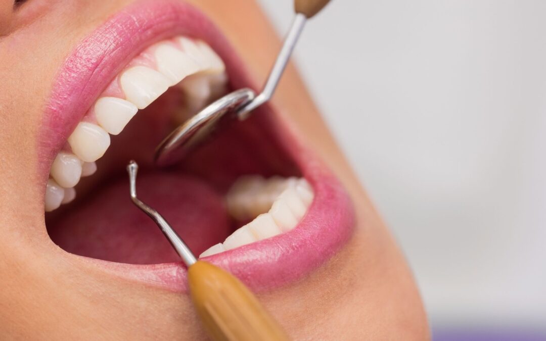 Devitalizzazione di un dente: che cos’è e quando e necessaria