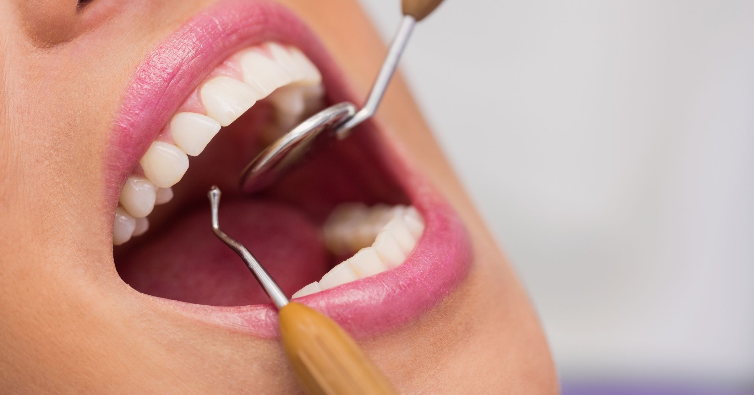 Devitalizzazione di un dente: che cos’è e quando e necessaria