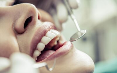 Otturazione dentale: tipologie e materiali
