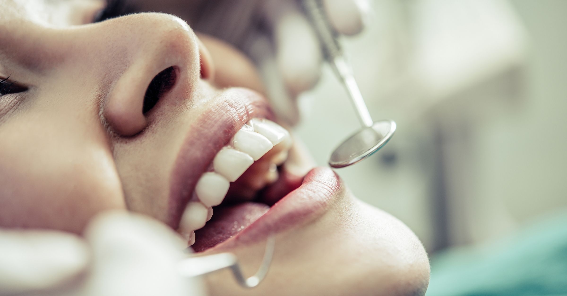 Otturazione dentale: tipologie e materiali