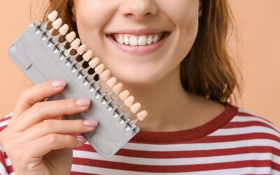 Faccette dentali: la soluzione per un sorriso perfetto