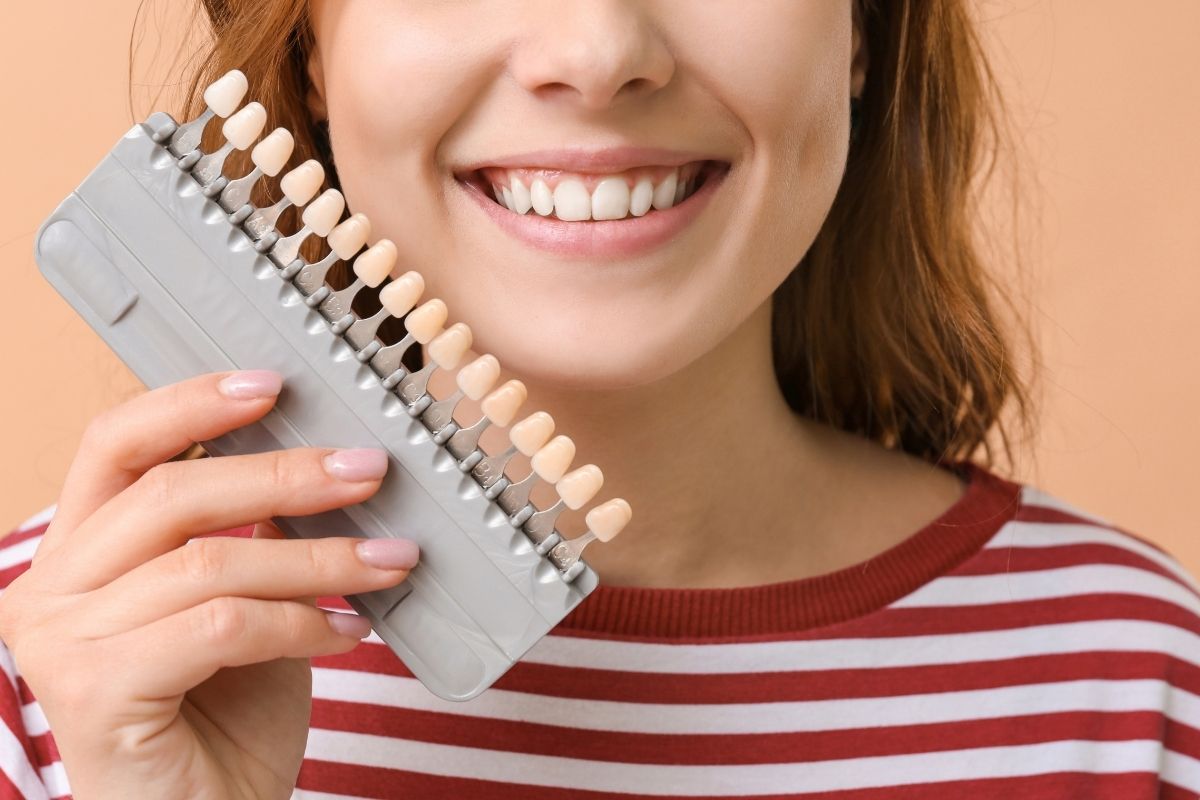Faccette dentali: la soluzione per un sorriso perfetto