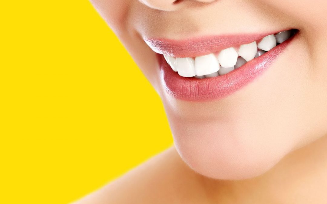 Come fanno i vip ad avere i denti perfetti: il “segreto” delle faccette dentali