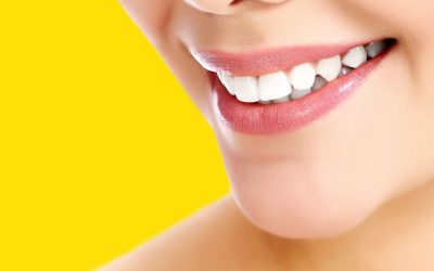 Come fanno i vip ad avere i denti perfetti: il “segreto” delle faccette dentali