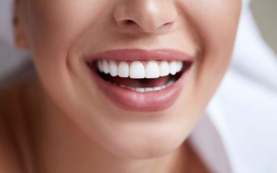 Fluorosi dentale: sintomi e trattamento
