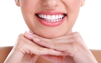 Sorriso Perfetto in poche sedute: come funzionano le faccette dentali